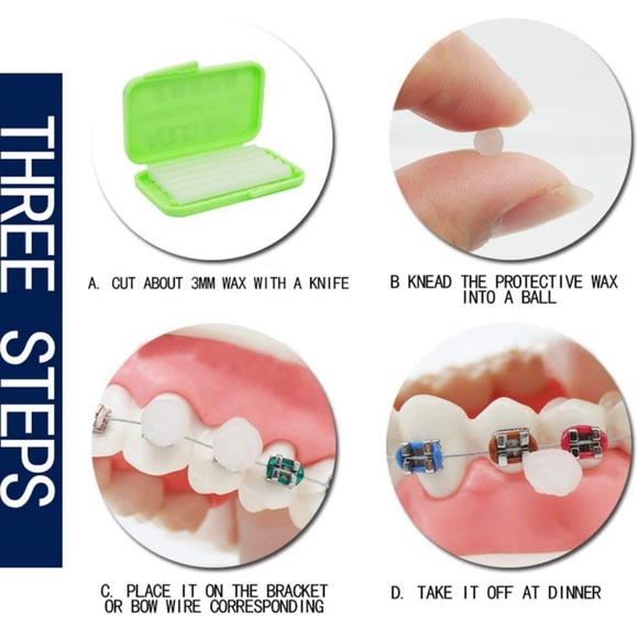 NEW Dental Oral Care Orthodontics Wax with Fruit Flavor for Brace Wearers 10Pack - Picture 2 of 7